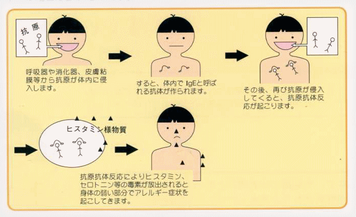 喘息発症のメカニズム