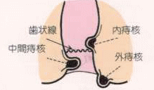 痔核（いぼ痔）の図
