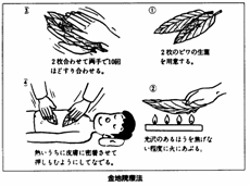 びわ金寺院療法