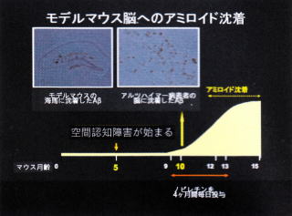 モデルマウス脳へのアミロイド沈着