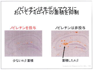 チンピはアミロイドの蓄積を抑制